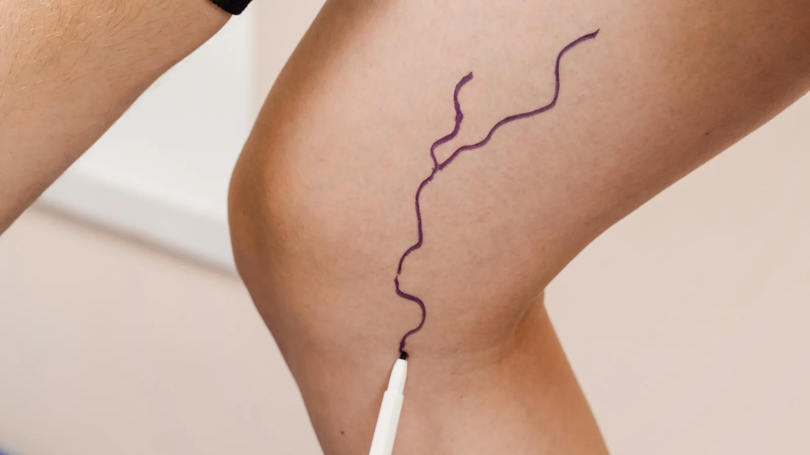 Especialista en problemas de circulación en Guadalajara